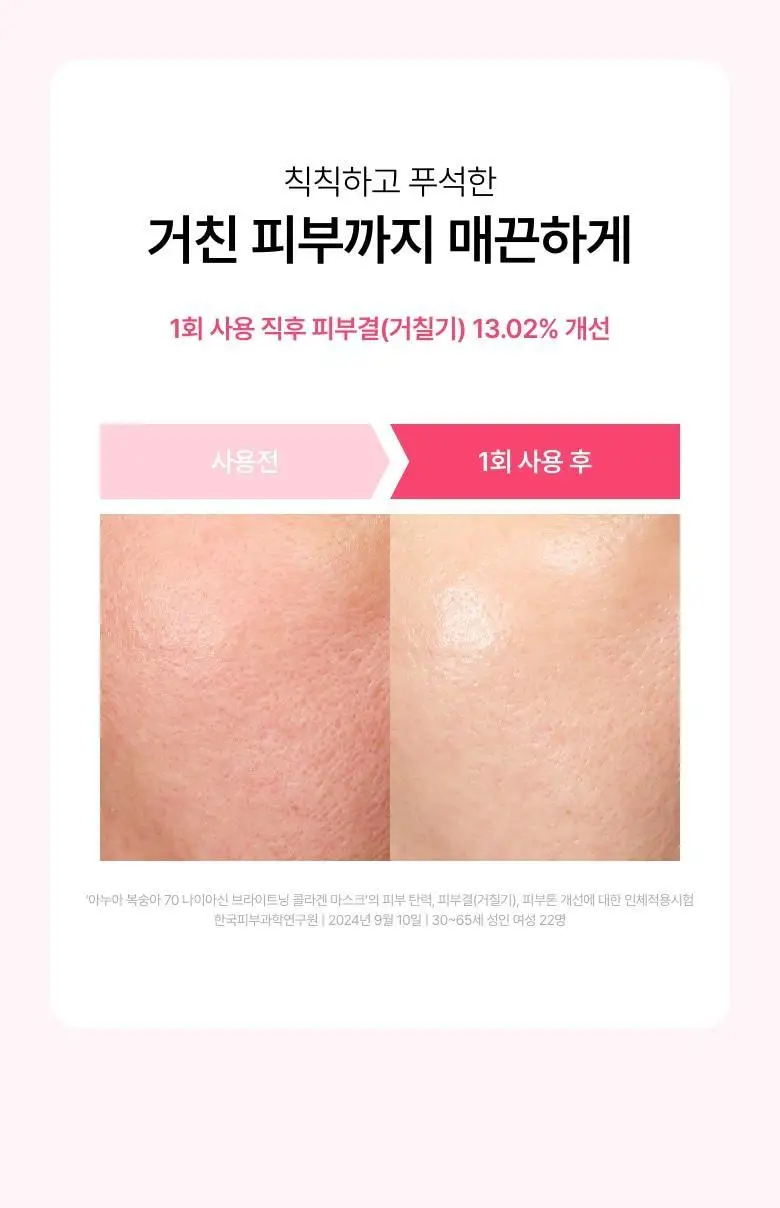 [탄력케어] 아누아 콜라겐 마스크 1매 3종(어성초/복숭아/라이스) 상세페이지 47